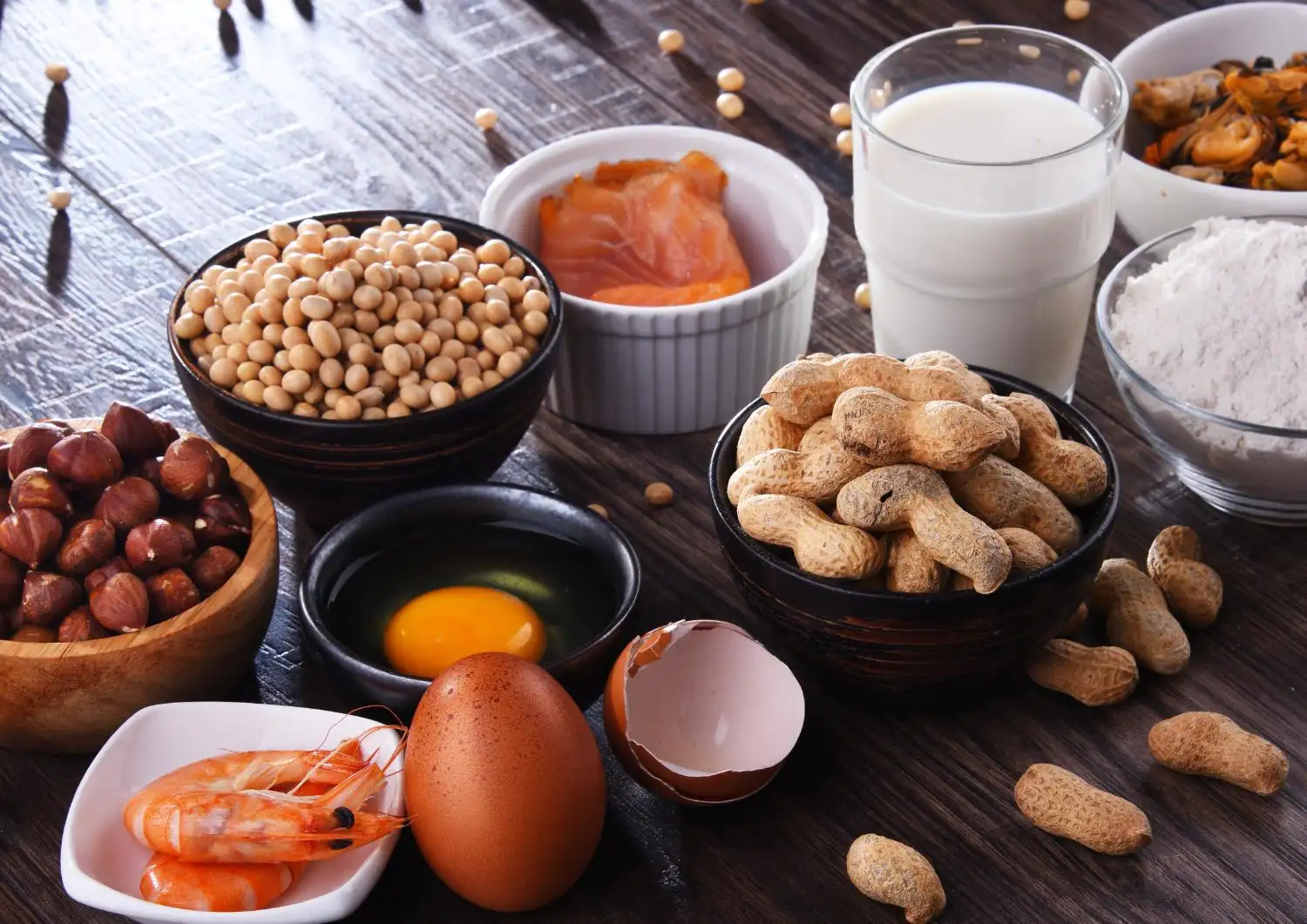 Allergeni alimentari